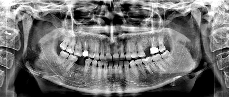 ОПТГ снимок в 2Д