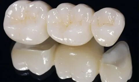 цельнокерамический мостовидный протез цельнокерамический мостовидный протез