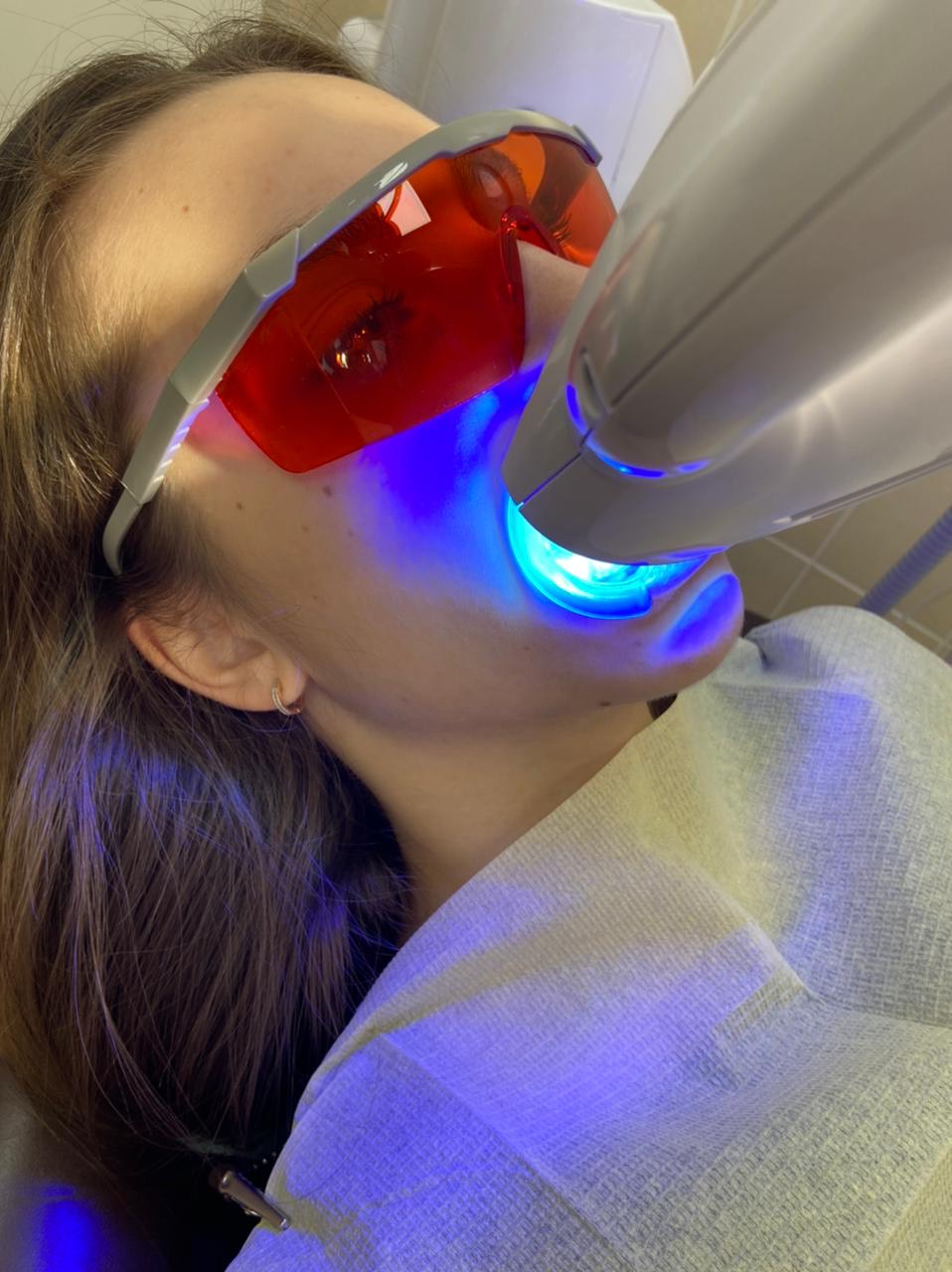 Отбеливание зубов технологией Beyond Polus